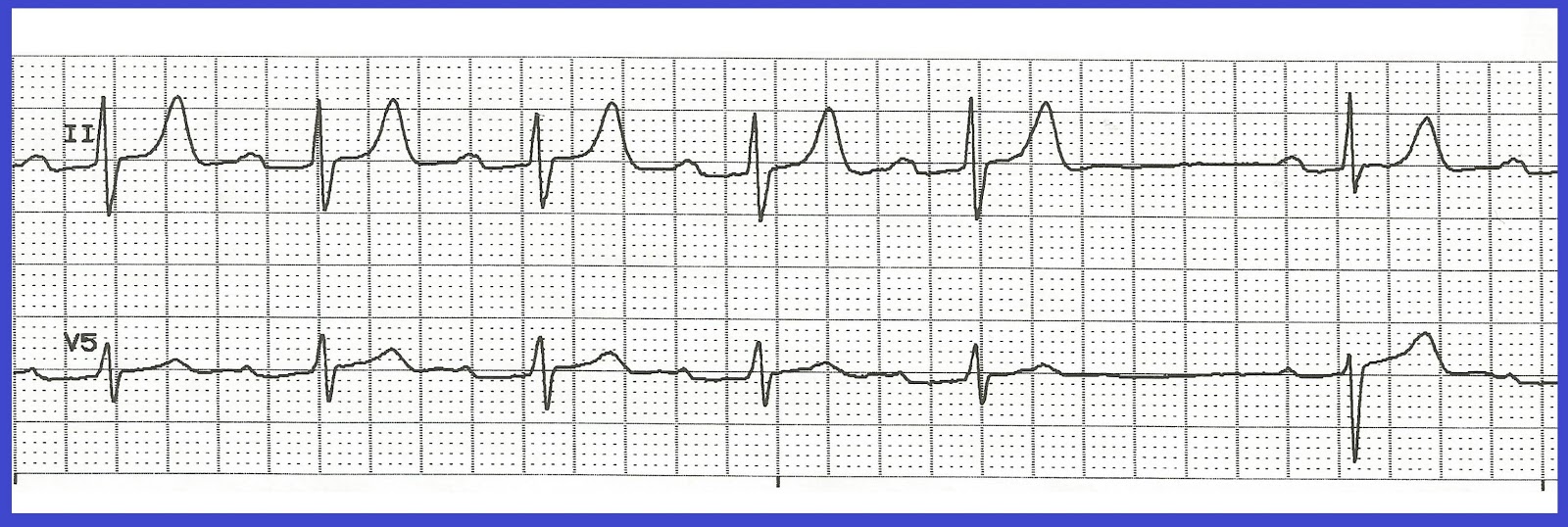 Was ecg rhythm strip interpretation interesting phrase Conversations! You ecg rhythm strip interpretation apologise, but
